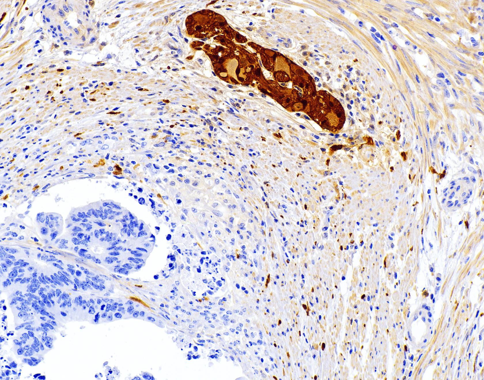 Scanner de lames pathologiques numériques AM-TRO-0061