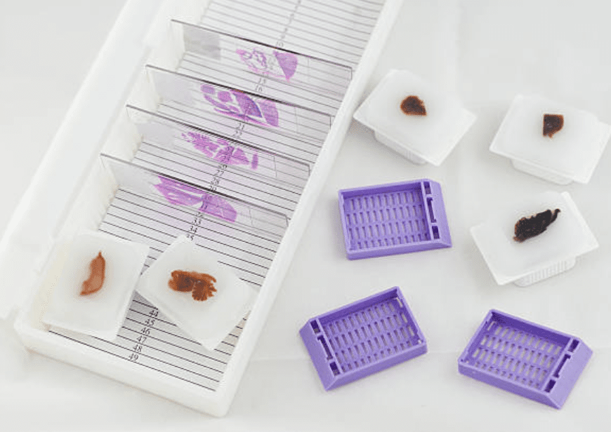 Histologie Produits pathologiques 1