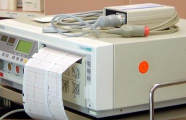 Was ist ein Elektrokardiogramm?