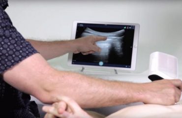 Application of ultrasound scanner