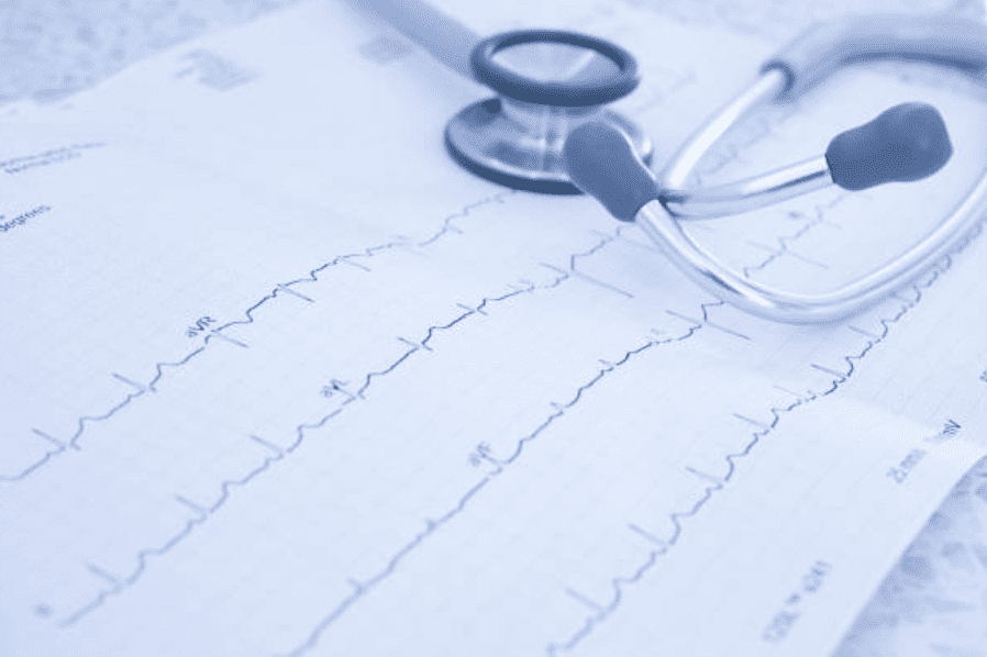 Portable ECG EKG Cardiograph Machine 1