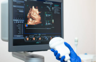 Digitales Farbdoppler-Ultraschallsystem 1 Digitales Farbdoppler-Ultraschallsystem 1
