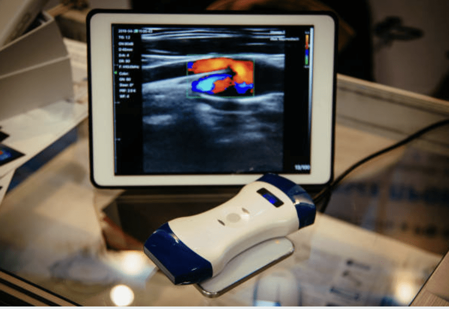 دوبلر الألوان المحمول