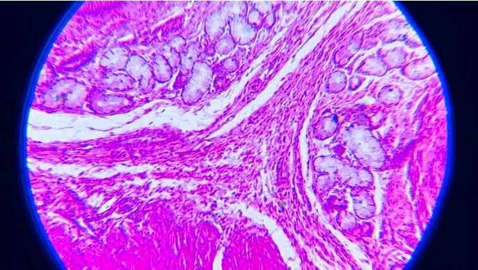 Prodotti di patologia