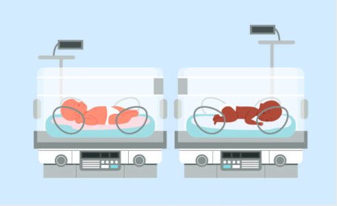 Säuglingsinkubator 2