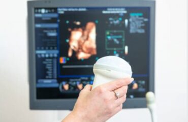 Doppler-Farb-Ultraschall-1 Wie kann Farbdoppler-Ultraschall Ihre medizinische Diagnostik verbessern?