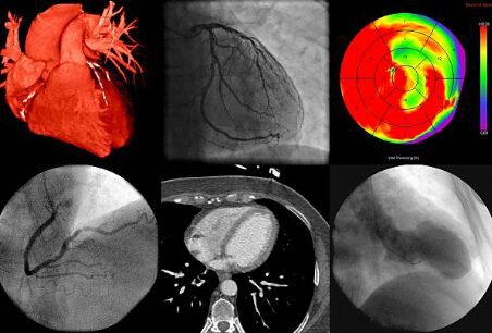 doppler test for heart 1