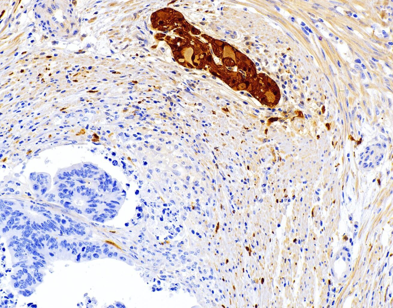 الماسح الضوئي الرقمي للشرائح المرضية: مستقبل التشخيص الطبي؟