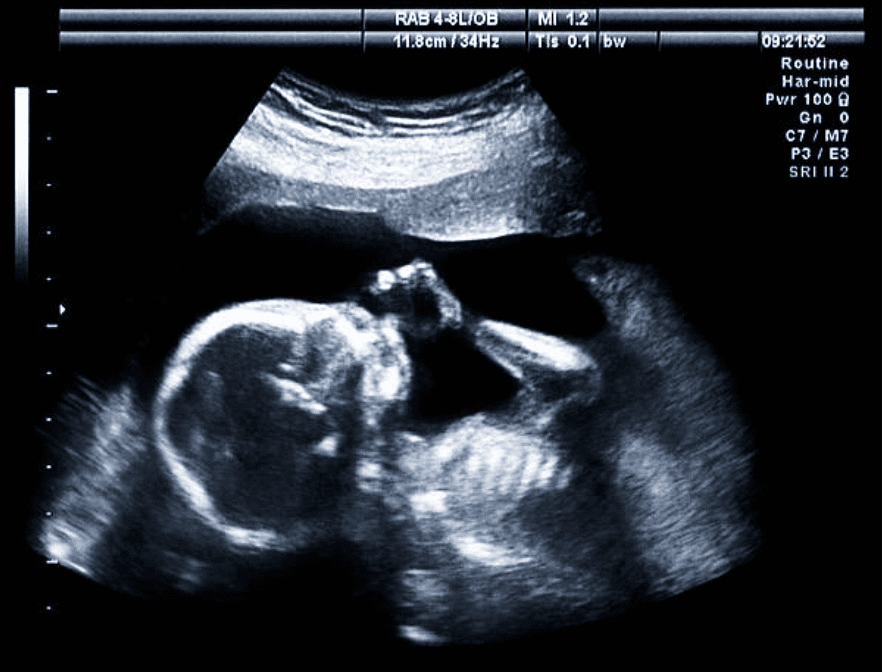 imagerie échographique 1