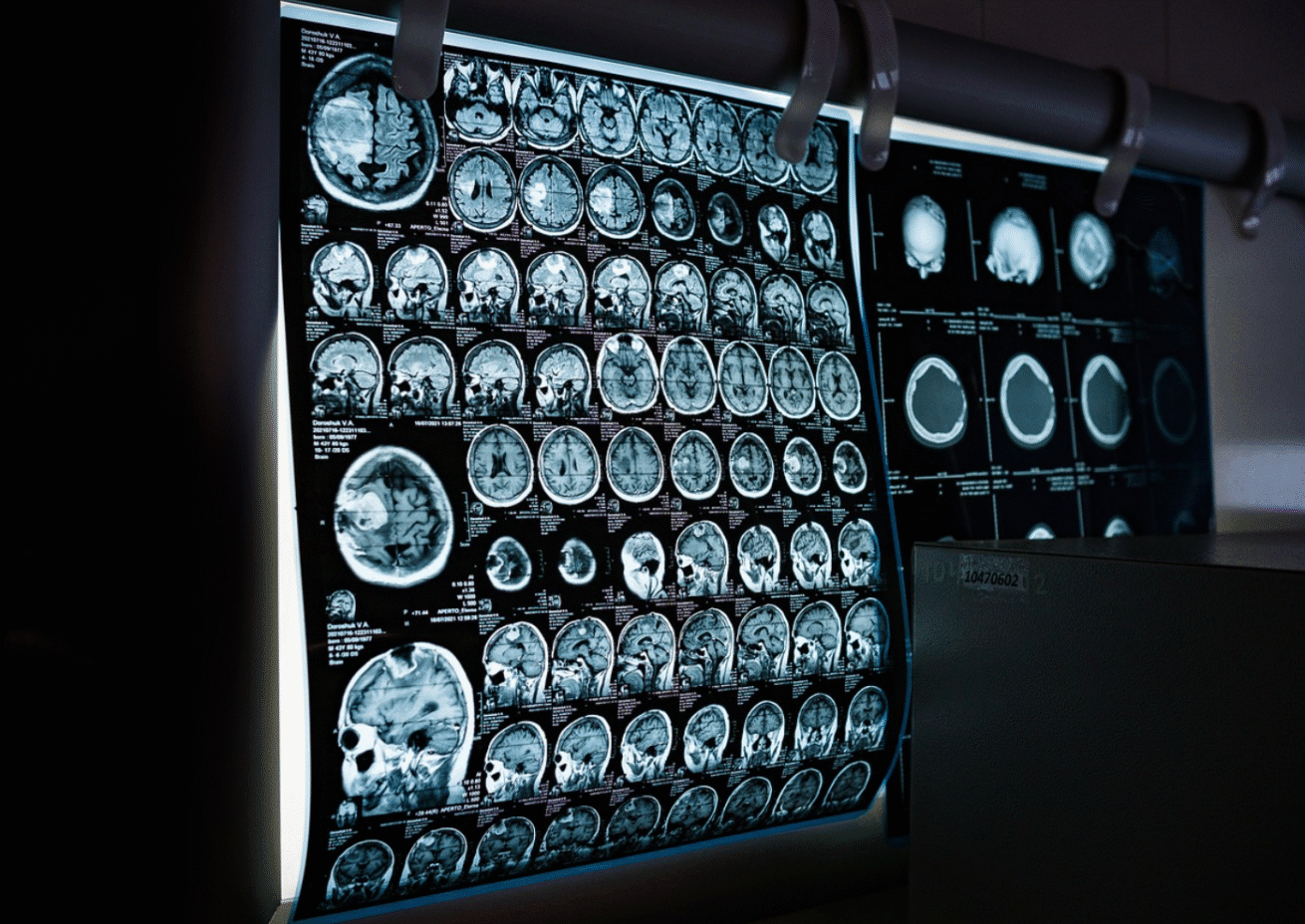 الأشعة السينية